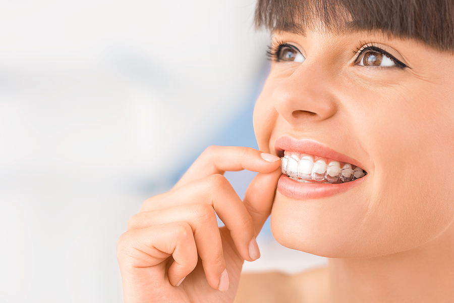 Invisalign Braces Invisalign Braces